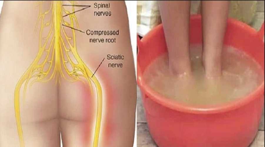 Say goodbye to sciatic nerve pain in just 10 minutes with this natural method! - NewsExplorer